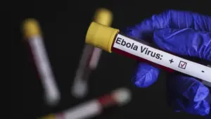 Orta Afrika’da Ebola Alarmı: Vakalar 20 Bini Bulabilir