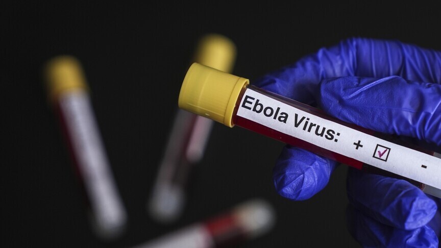 DSÖ’den Ebola Uyarısı: Salgın Kontrol Altına Alınamıyor